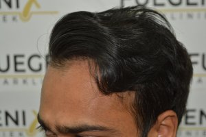 2_Dr.-Munib-Ahmad-2560g-From-Insecure-with-a-Hairsystem-to-Confident-Young-Man-16