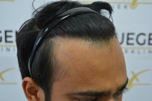 2_Dr.-Munib-Ahmad-2560g-From-Insecure-with-a-Hairsystem-to-Confident-Young-Man-22