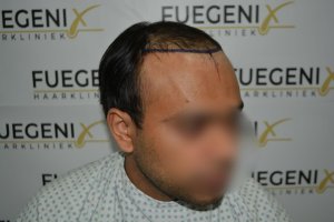 2_Dr.-Munib-Ahmad-2560g-From-Insecure-with-a-Hairsystem-to-Confident-Young-Man-7