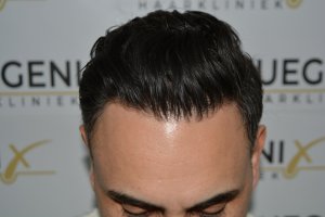 The-Bollywood-Hairline-10