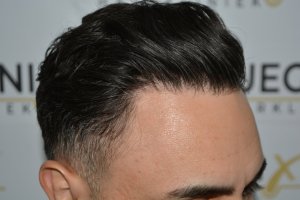 The-Bollywood-Hairline-15