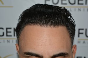 The-Bollywood-Hairline-22