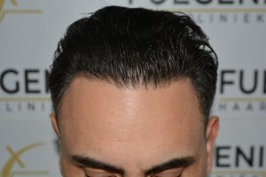 The-Bollywood-Hairline-23