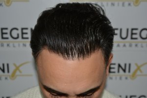 The-Bollywood-Hairline-25