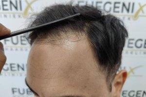 The-Bollywood-Hairline-3