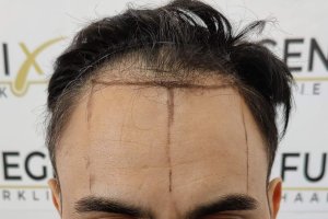 The-Bollywood-Hairline-5