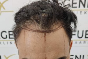 The-Bollywood-Hairline-6