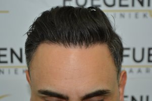 The-Bollywood-Hairline-7