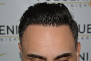 The-Bollywood-Hairline-8