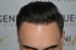 The-Bollywood-Hairline-9