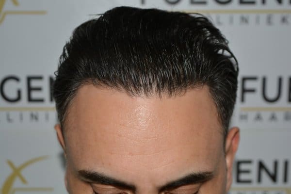 The-Bollywood-Hairline-23