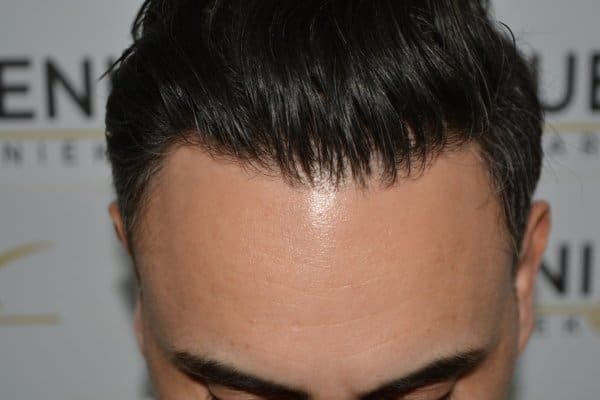 The-Bollywood-Hairline-31